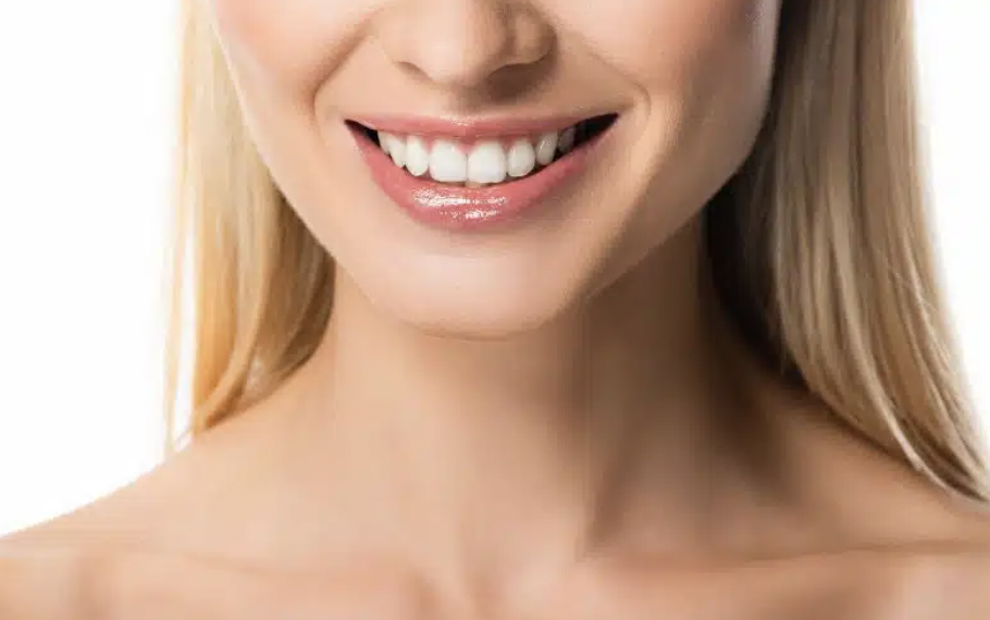 Tooth whitening