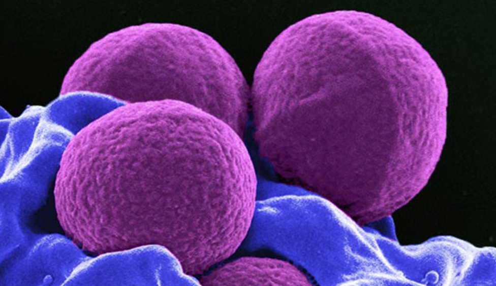 methicillin resistant staphylococcus aureus