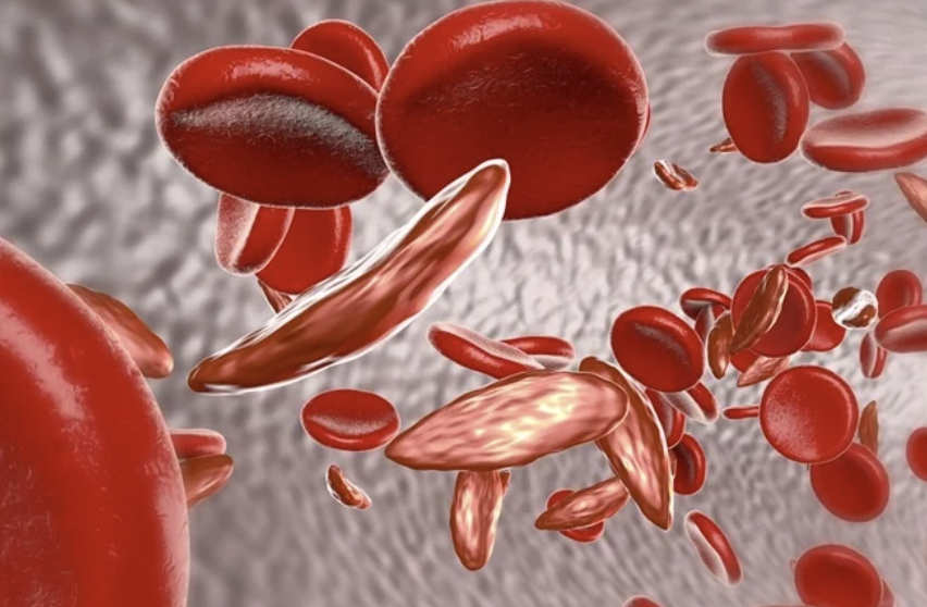 3d sickle cell