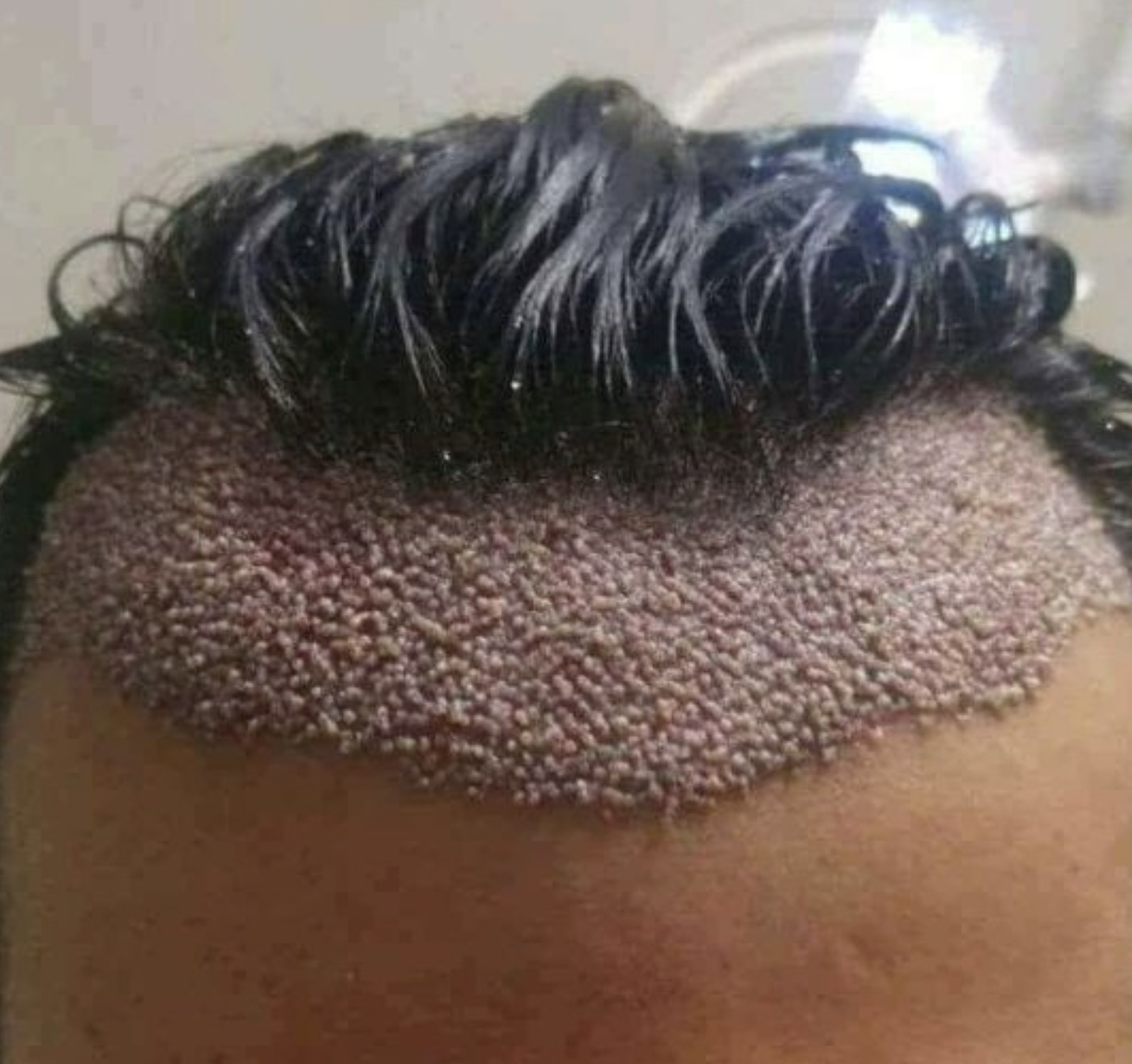 head hair