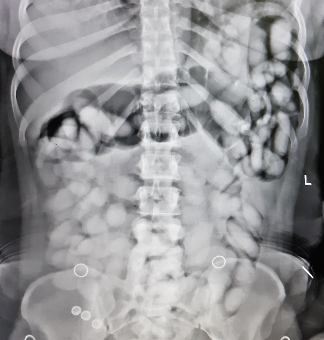 21 X-Ray Pics of Smugglers Caught at the Border