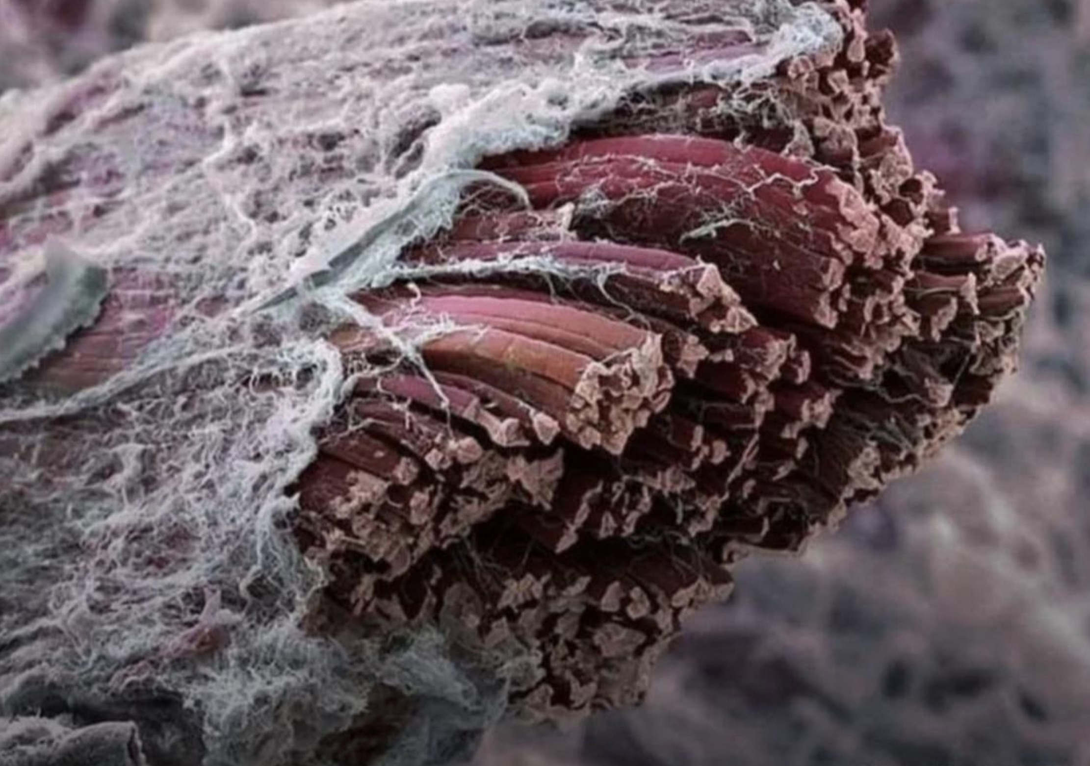 muscle under electron microscope