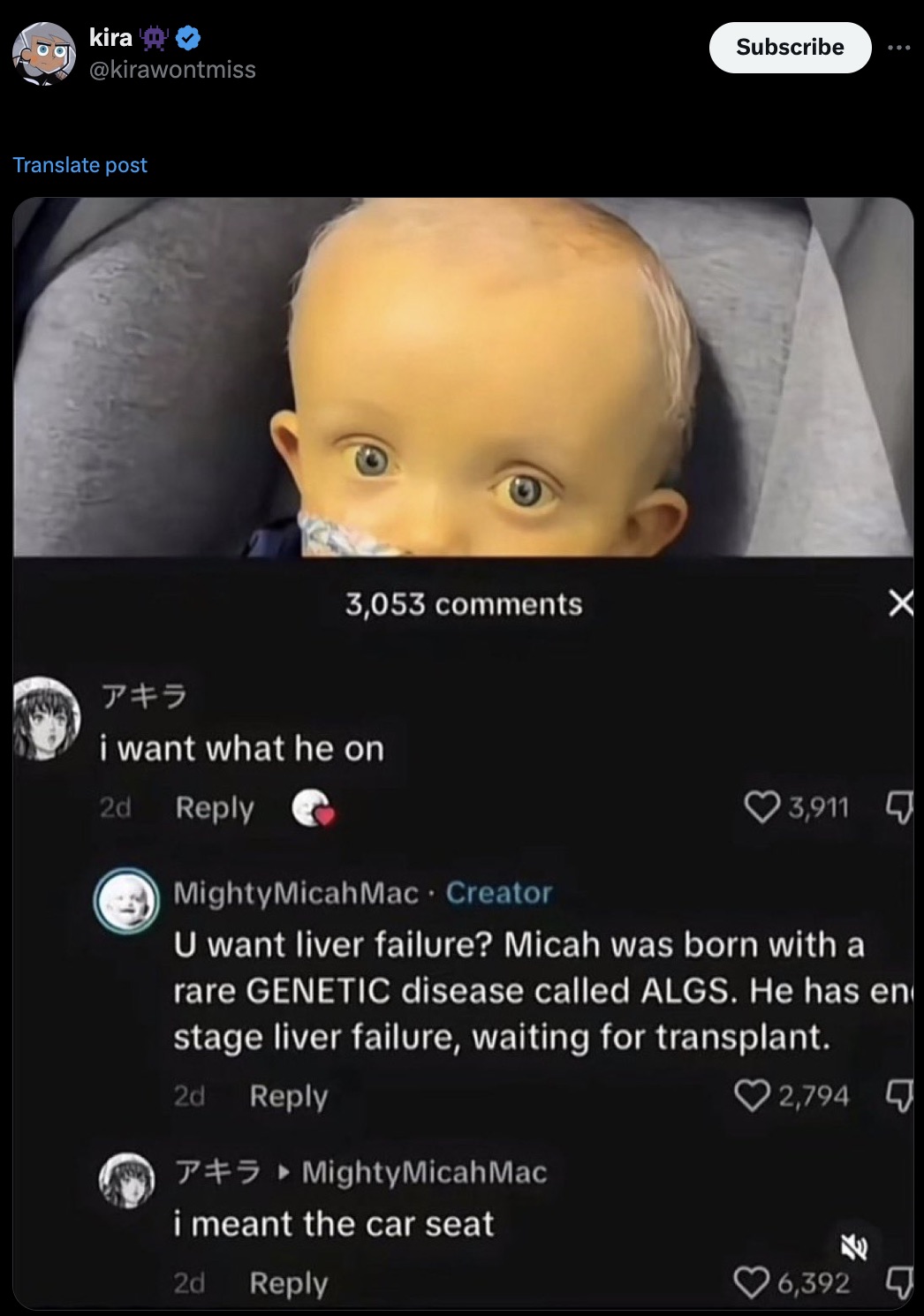 screenshot - kira Translate post Subscribe 3,053 i want what he on 2d MightyMicah Mac Creator 3,911 U want liver failure? Micah was born with a rare Genetic disease called Algs. He has en stage liver failure, waiting for transplant. 2d Mighty Micah Mac i 