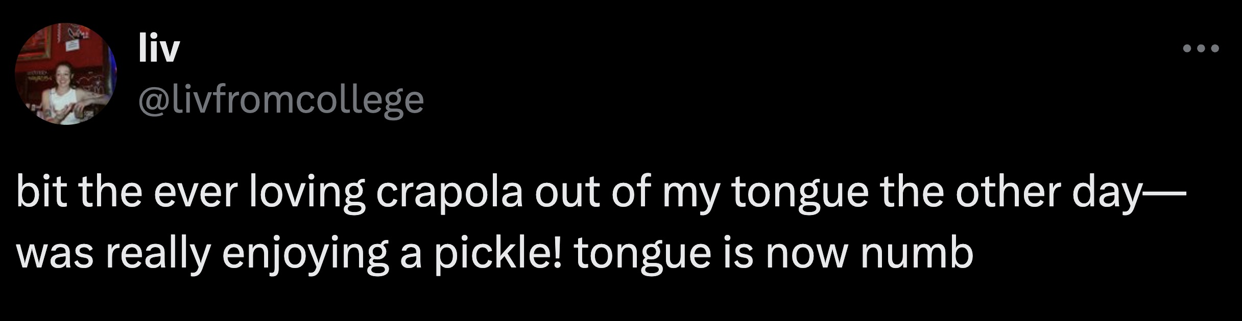 screenshot - liv 2D bit the ever loving crapola out of my tongue the other day was really enjoying a pickle! tongue is now numb