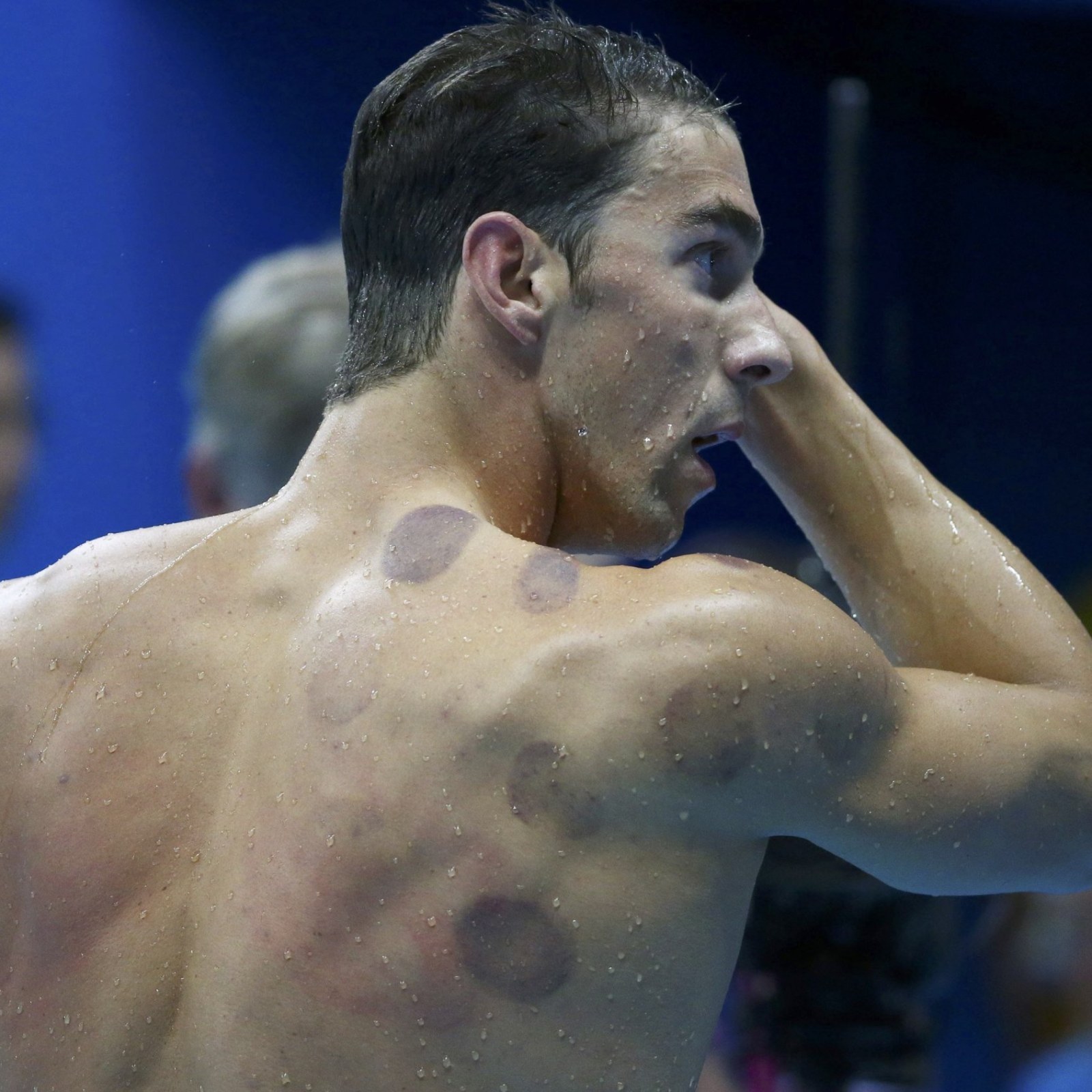 Fairly recently, athletes have brought the practice of “cupping” back into the spotlight. But while the silly-looking purple welts on Michael Phelps’s back might not look familiar, they are actually part of a revival of a 3,500-year-old ancient Egyptian practice.