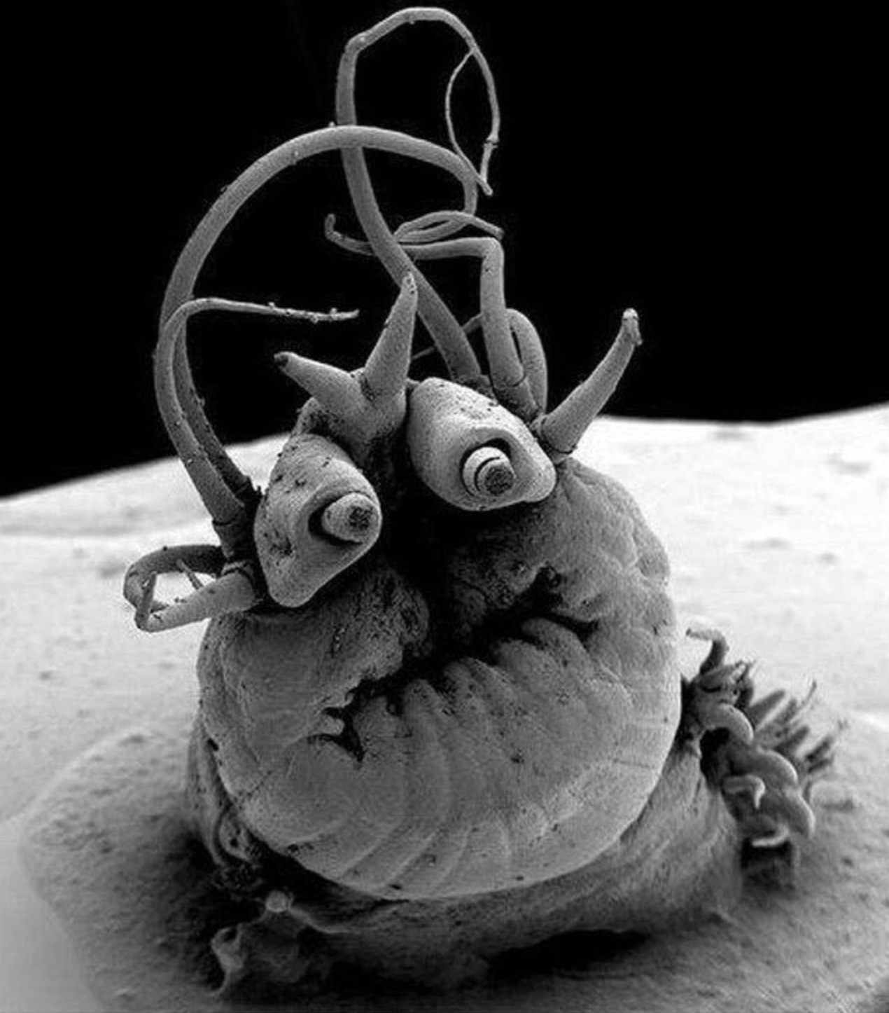 worm under electron microscope