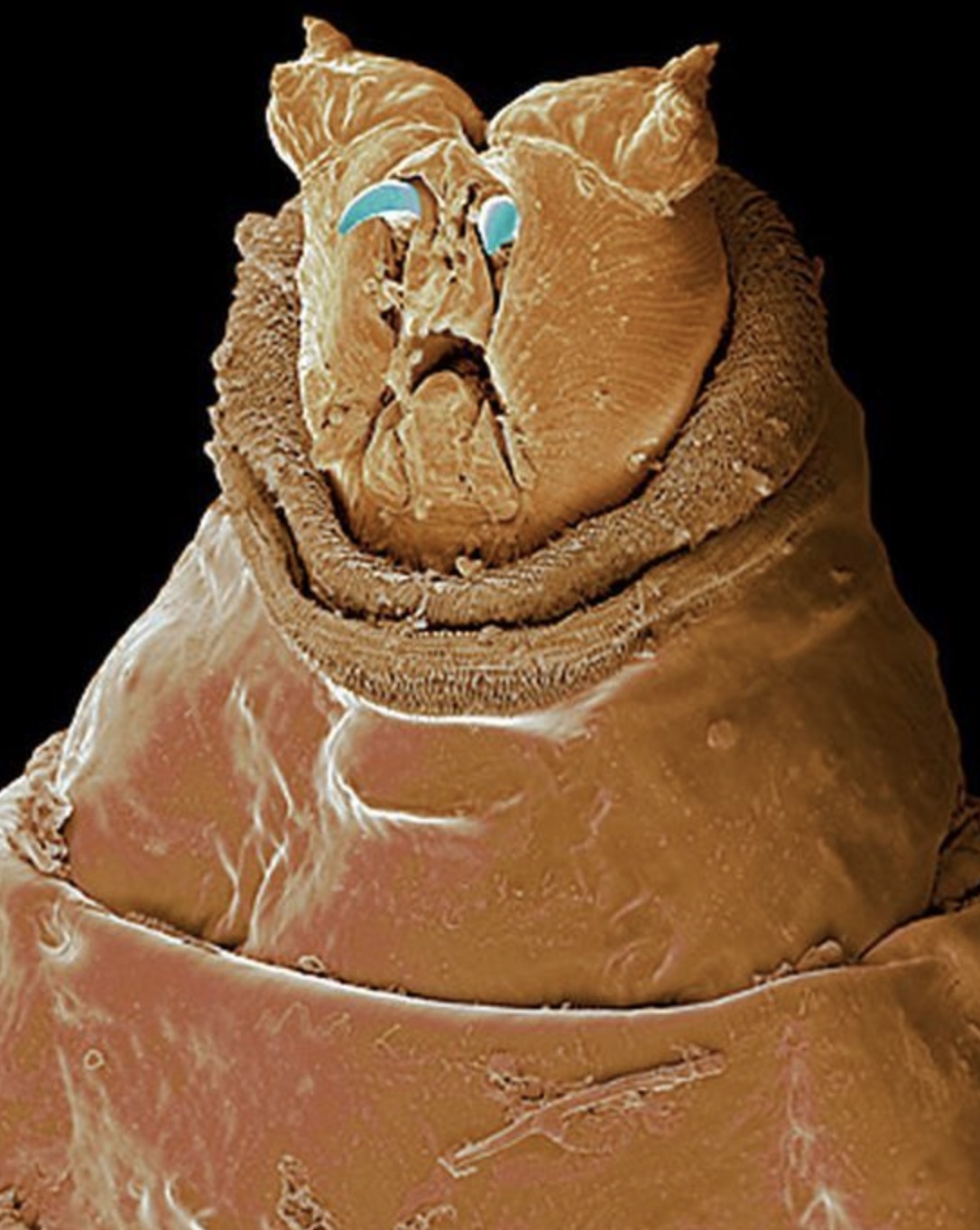 maggot microscope