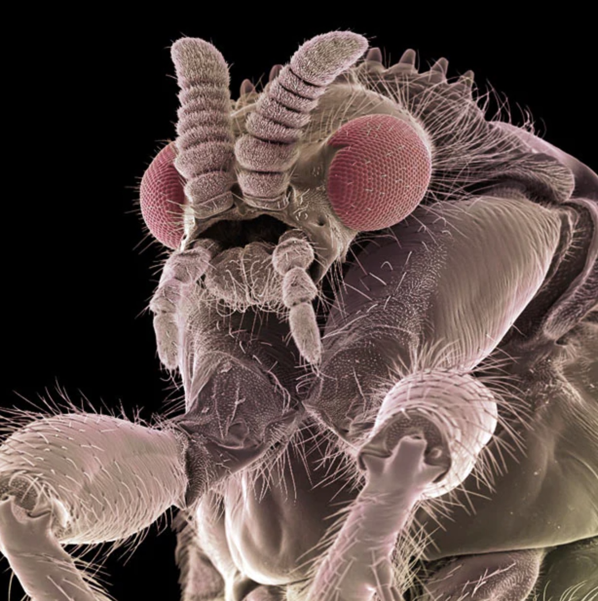 electron microscope bugs