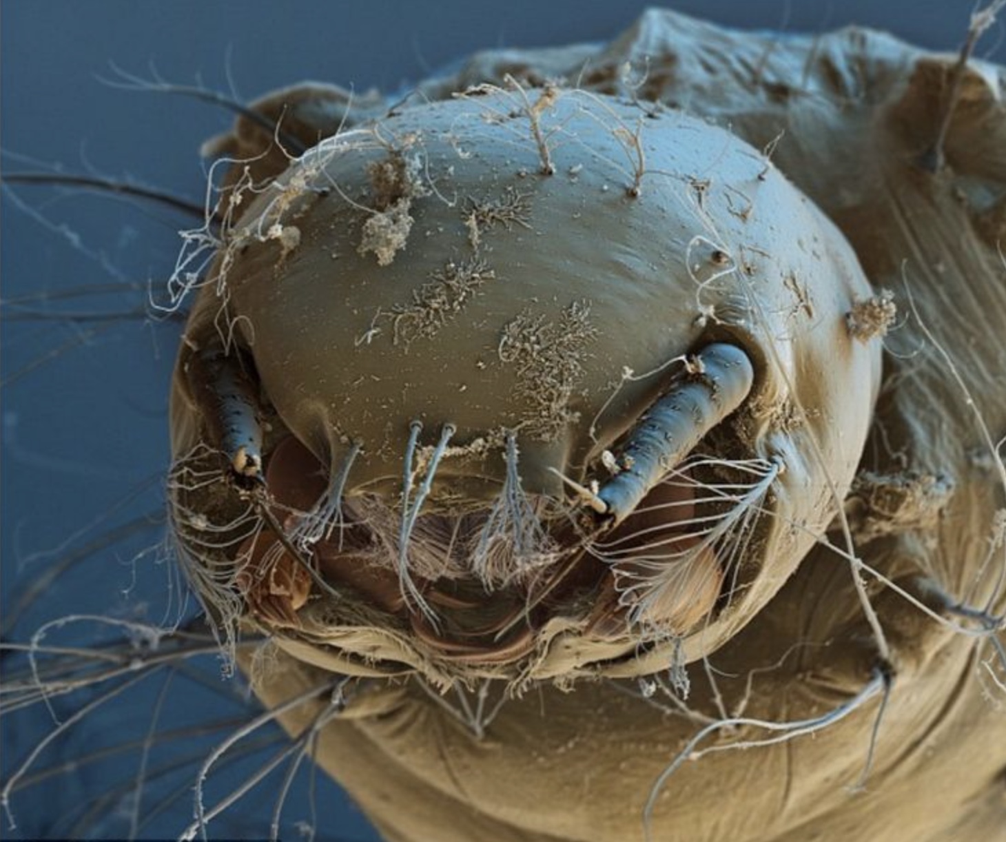 mosquito larvae under microscope