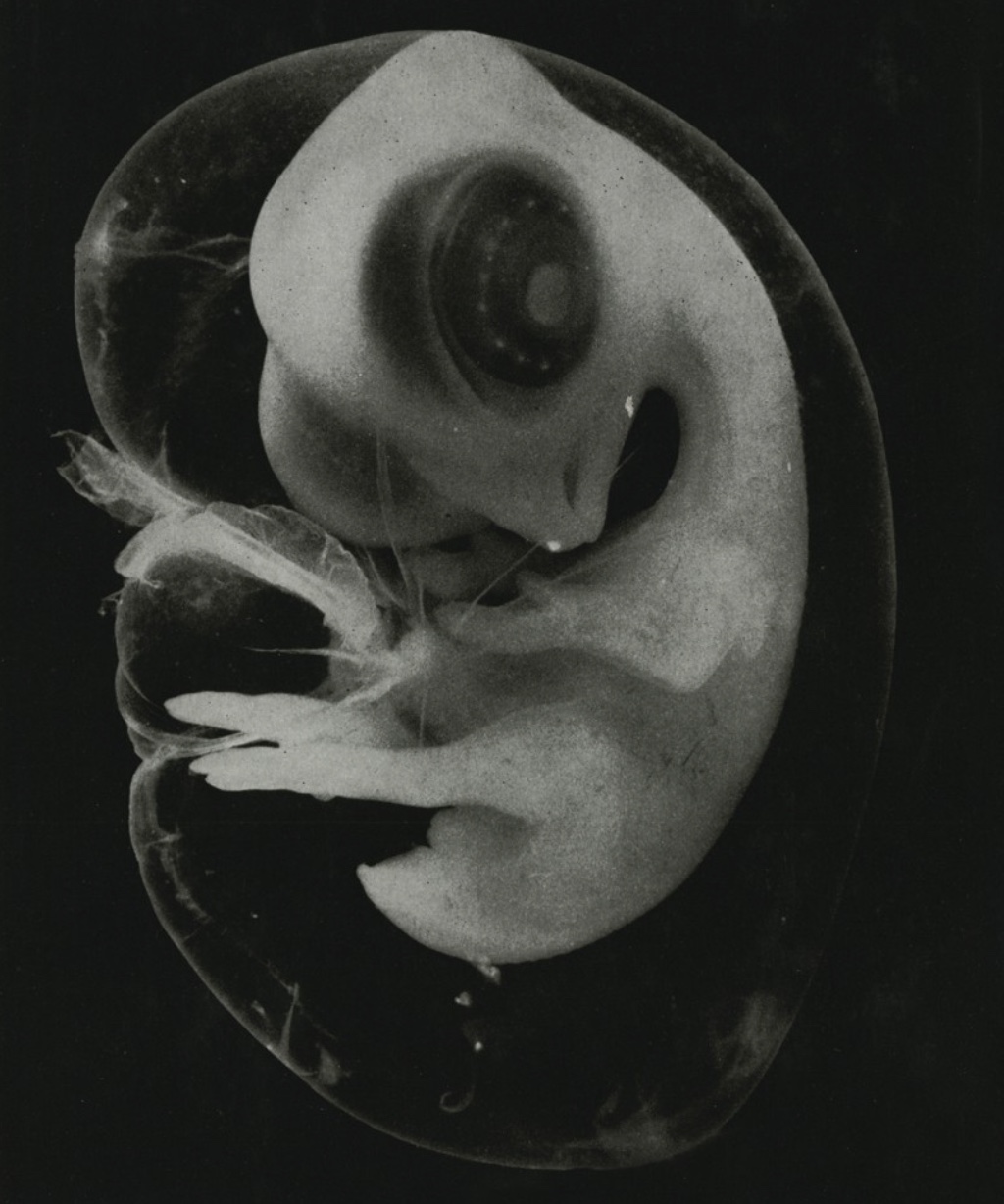 32 Animal Embryos That Look Like Baby Aliens