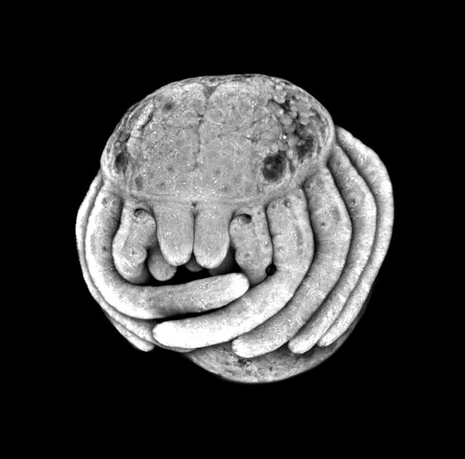 32 Animal Embryos That Look Like Baby Aliens