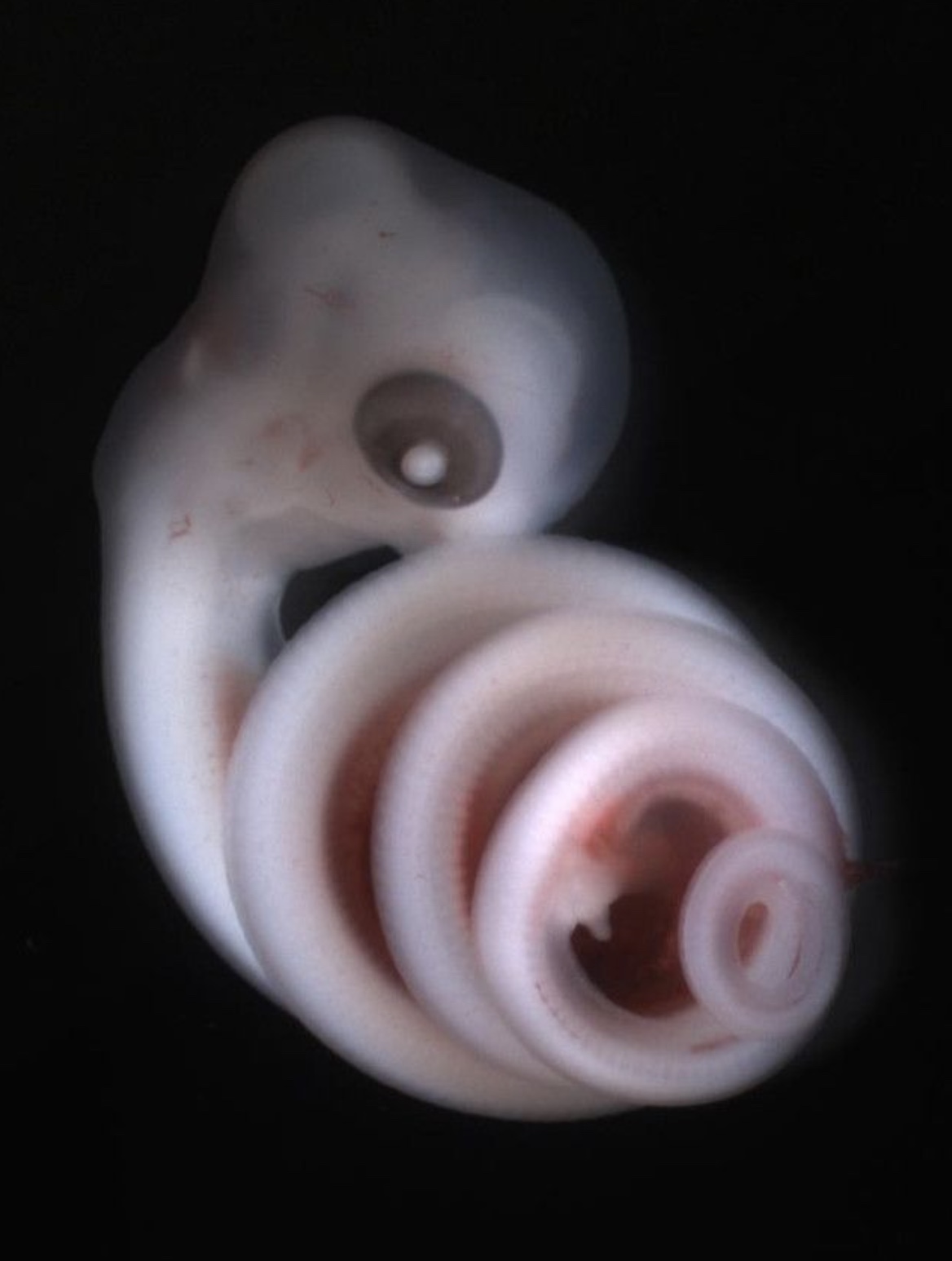 32 Animal Embryos That Look Like Baby Aliens