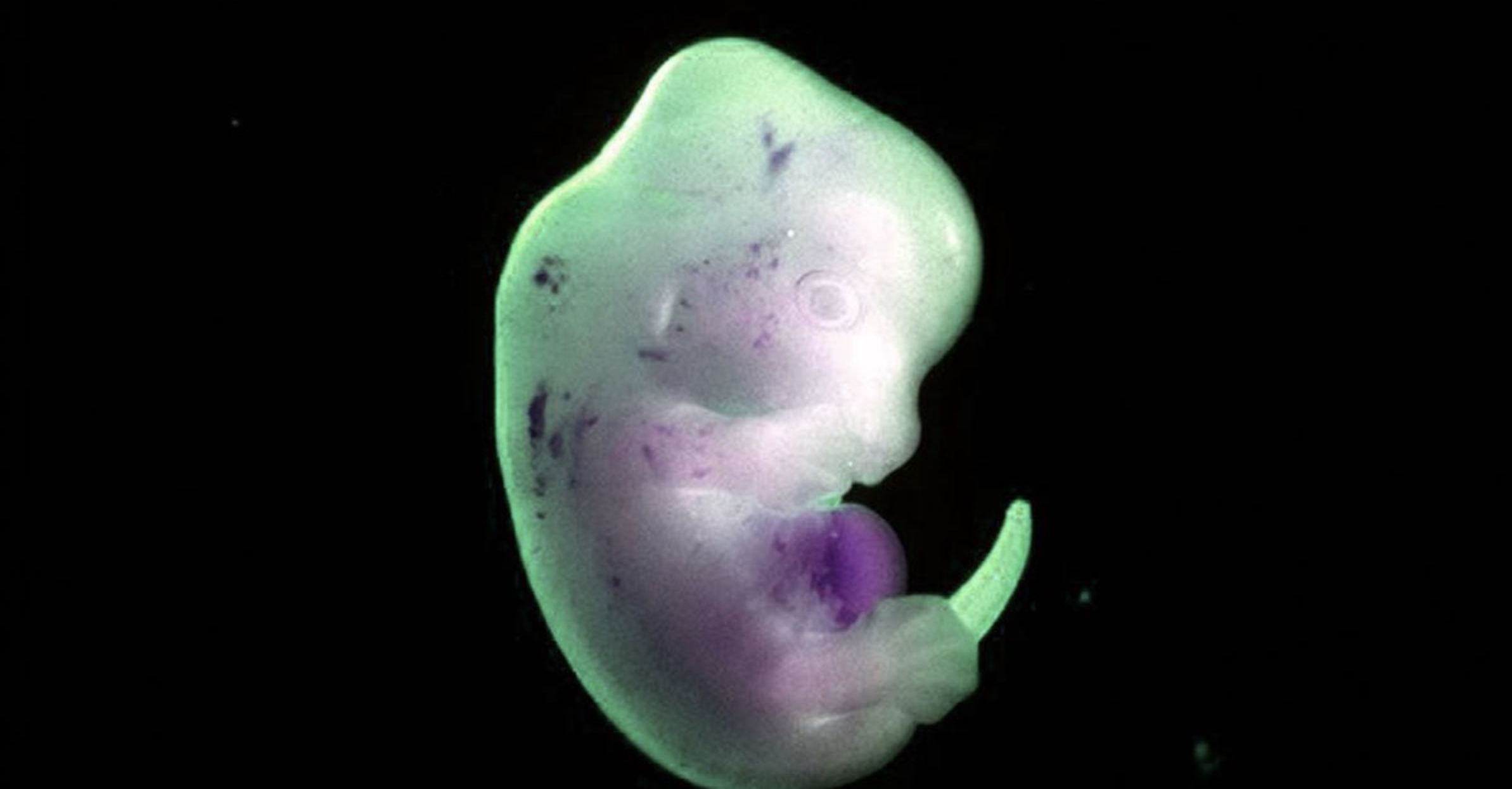 32 Animal Embryos That Look Like Baby Aliens