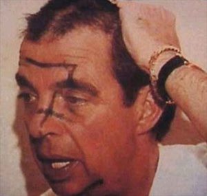 Morton Downey's "Skinhead Hoax"