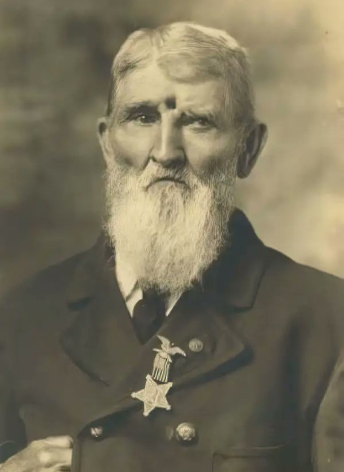 A Bullet to the Brain... and He Lived