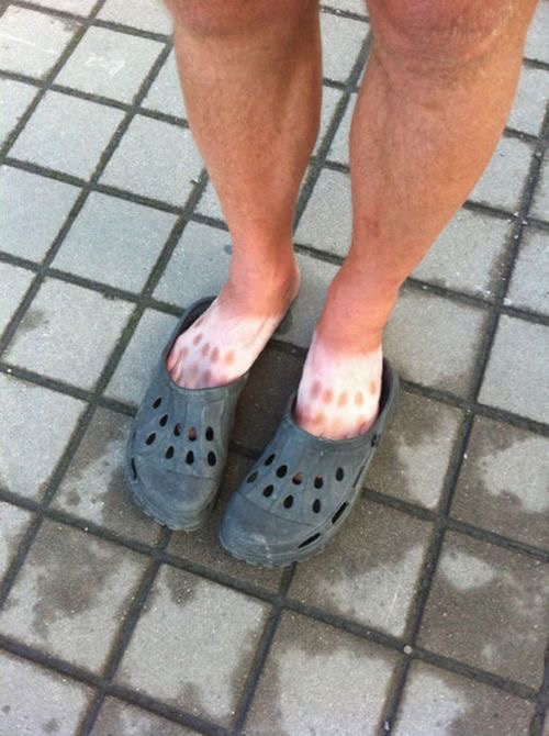 Crocs + Sun = Tactical Tan Fail