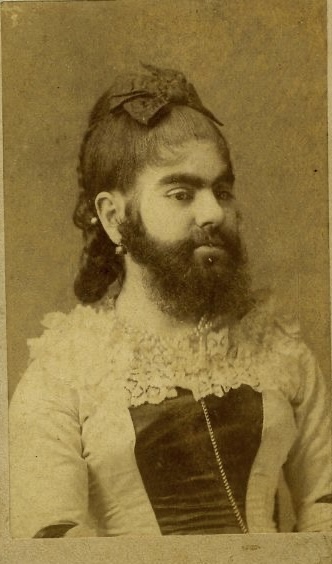 Beard Girl: The Lumberjack Years