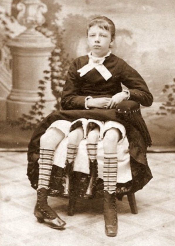 Legs for Days. And Then Some.