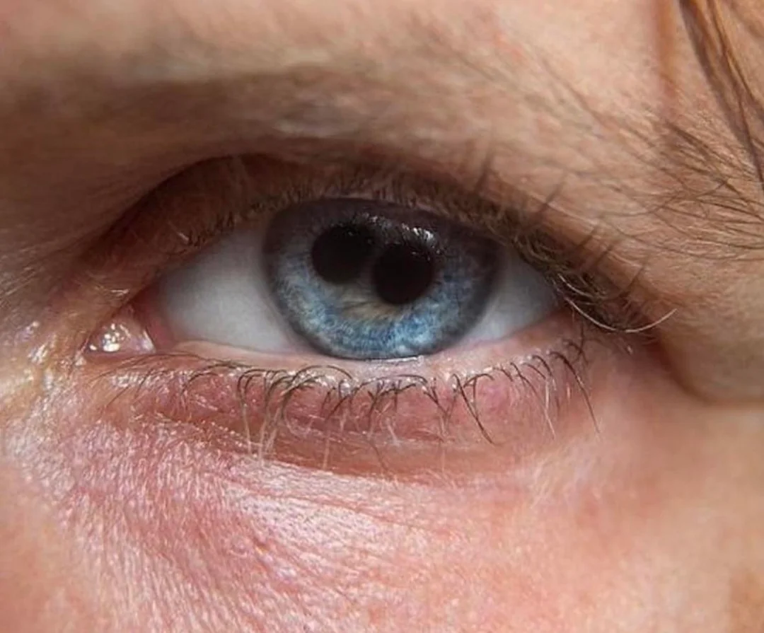 Vision must be extra perfect.