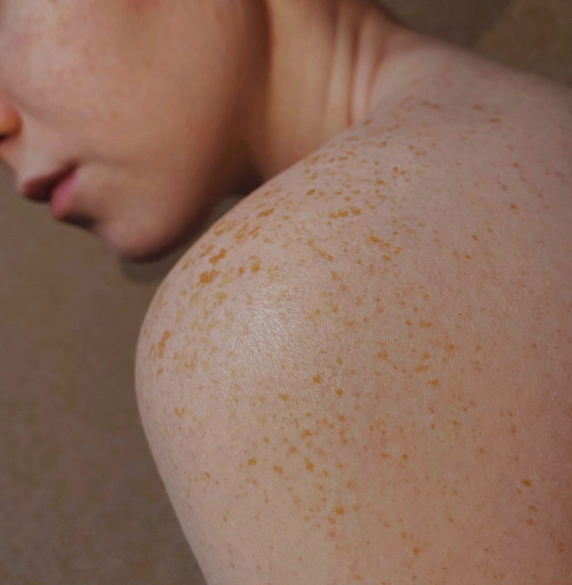 Your Body Has Built-In Spider Webs