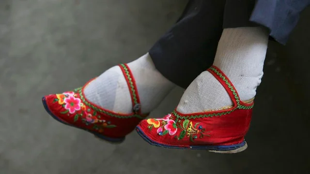 Chinese foot binding