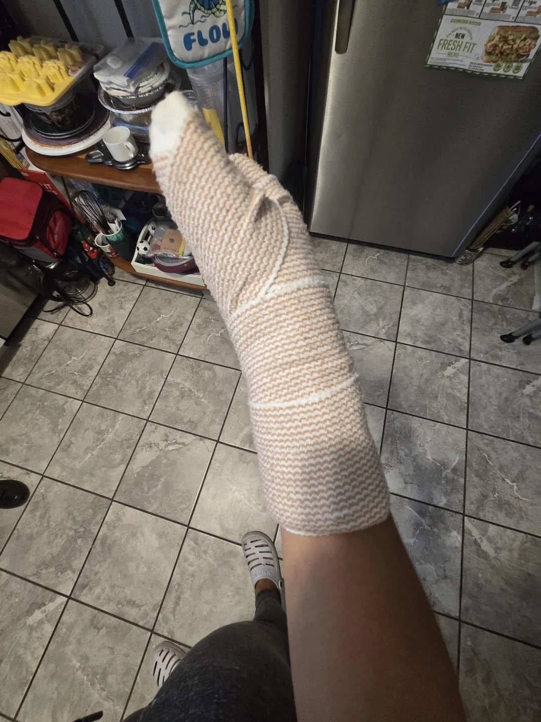 "Saw a guy in a bar fight swing back using his arm in a cast. He landed a solid hit, and police arrested him for assault with a deadly weapon."