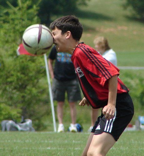 Ball to the Face: Childhood Edition