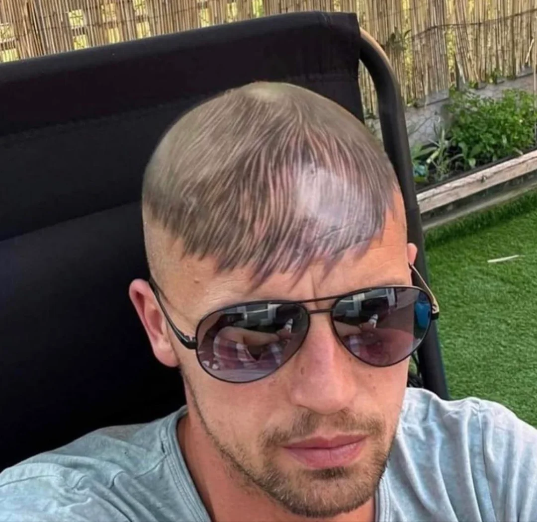 He missed his hair and the tattoo artist said "say no more".