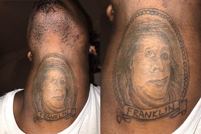 Benjamin Franken-monkey