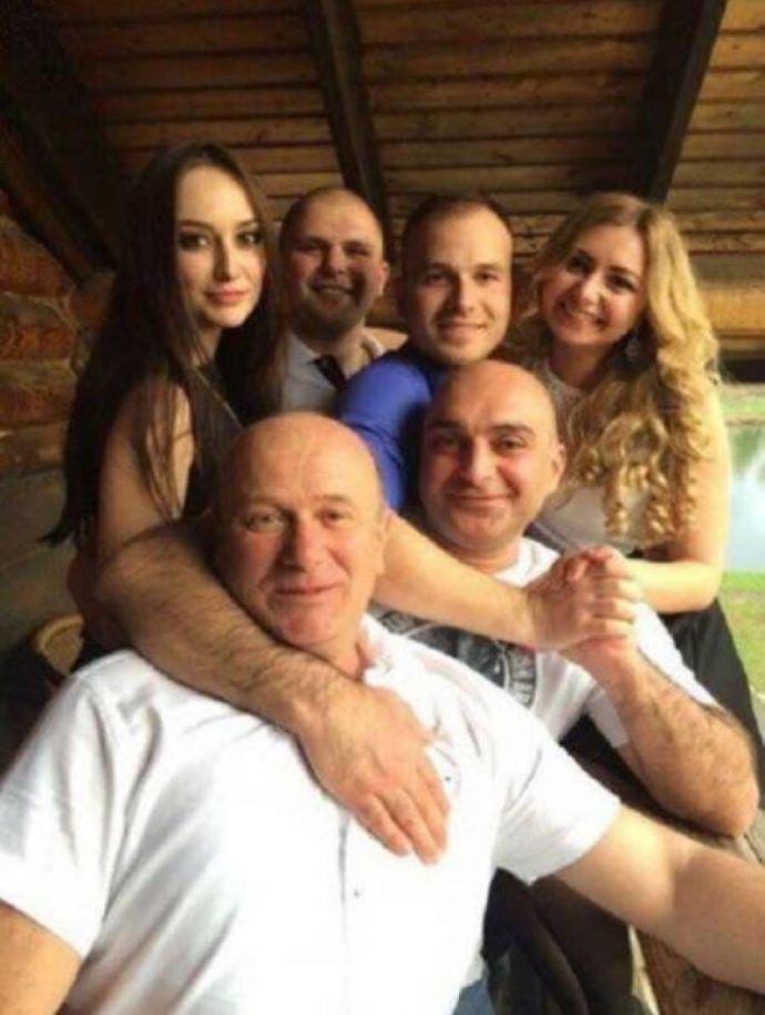 Woman Who Appears to Have a Man’s Arm