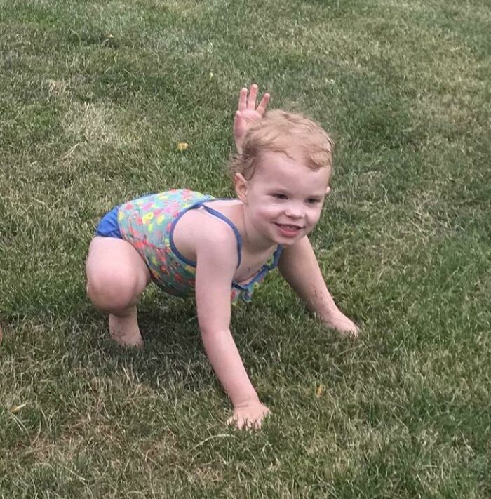 A baby with three arms