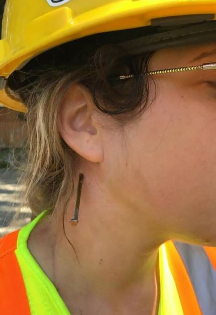 A nail went the wrong way