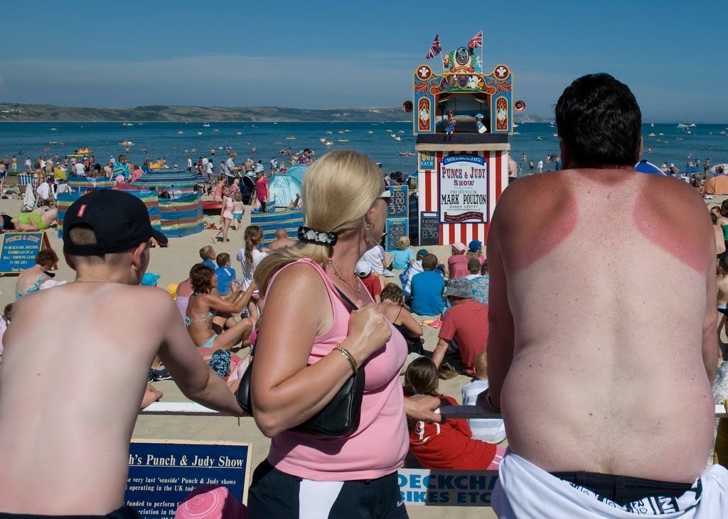 Beach Day Leaves Man with a Permanent Tank Top Tattoo