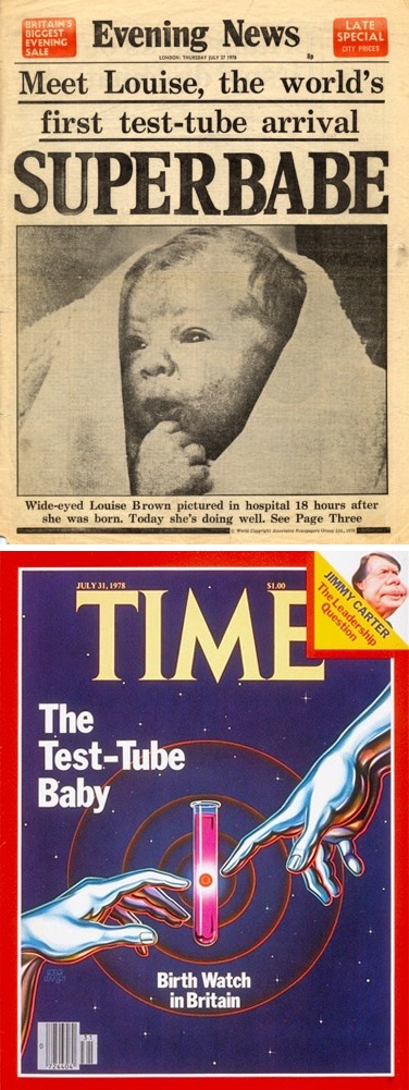 The First Test-Tube Baby Is Born (1978)