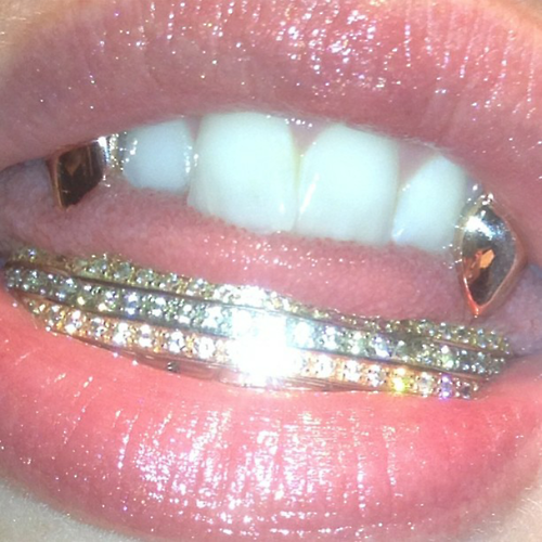 gold teeth jewel