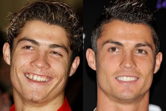 cristiano ronaldo before and after