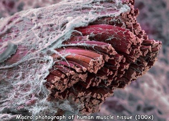 electron microscope muscle - Macro photograph of human muscle tissue 100x