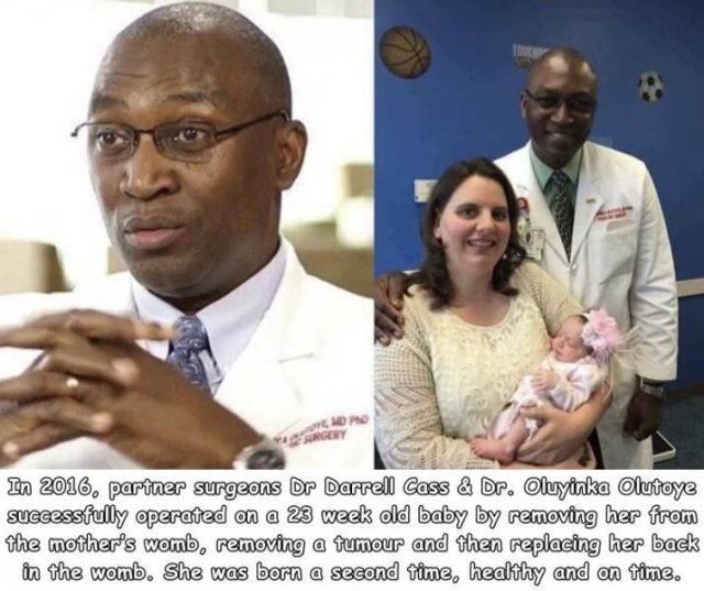 oluyinka olutoye - Te Ko Urgery In 2016, parter surgeons Dr Darrell Cass & Dr. Oluyinka Olutoye successfully operated on a 23 week old baby by removing her from the mother's womb, removing a tumour and then replacing her back in the womb. She was born a s