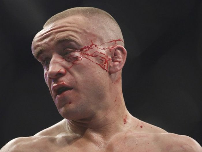 worst ufc post fight faces