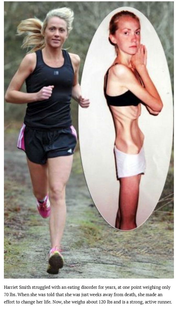 Harriet Smith struggled with an eating disorder for years, at one point weighing only 70 lbs. When she was told that she was just weeks away from death, she made an effort to change her life. Now, she weighs about 120 lbs and is a strong, active runner.