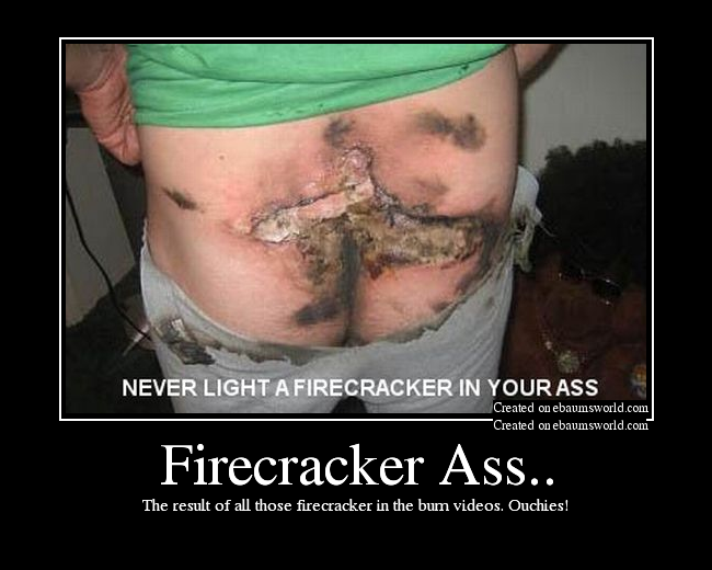 The result of all those firecracker in the bum videos. Ouchies!