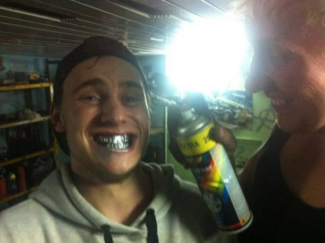 spray paint teeth