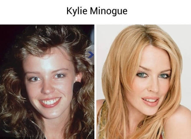 Celebrities Now & Before They Were Famous