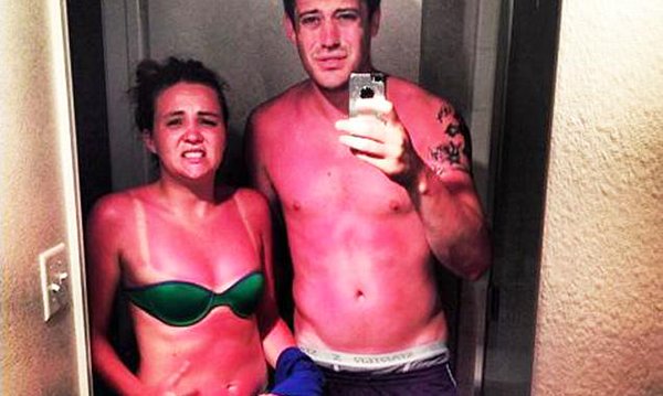 Some Of The Worst Tanning Fails Ever