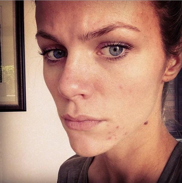 You Won't Believe What Model Brooklyn Decker Looks Like Without Makeup