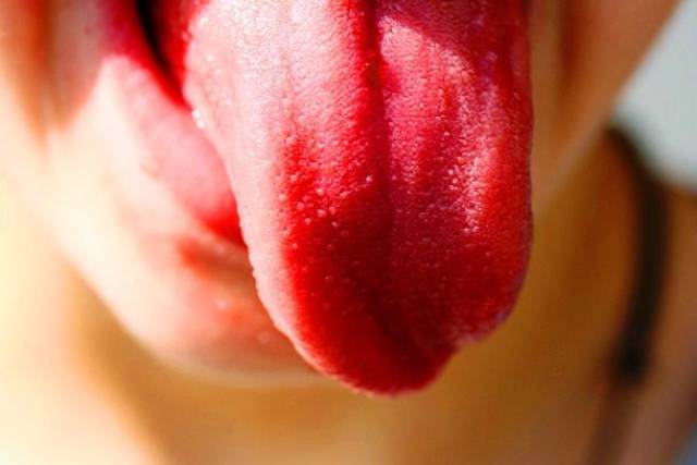 A glossy, bright red tongue may be a sign your body is lacking iron or Vitamin B12.