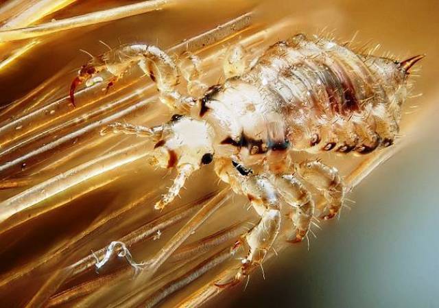 All parasites that thrive on human existence, such as head lice and body lice, would go extinct.