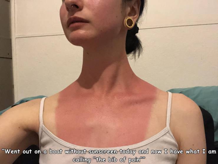 neck - "Went out on a boat without sunscreen today and now I have what I am calling the bib of painmas