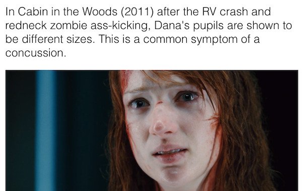 head - In Cabin in the Woods 2011 after the Rv crash and redneck zombie asskicking, Dana's pupils are shown to be different sizes. This is a common symptom of a concussion.
