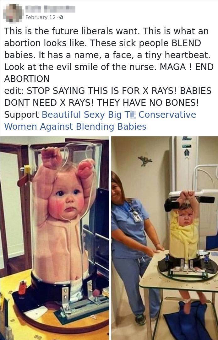 babies don t have bones - February 12 This is the future liberals want. This is what an abortion looks . These sick people Blend babies. It has a name, a face, a tiny heartbeat. Look at the evil smile of the nurse. Maga! End Abortion edit Stop Saying This
